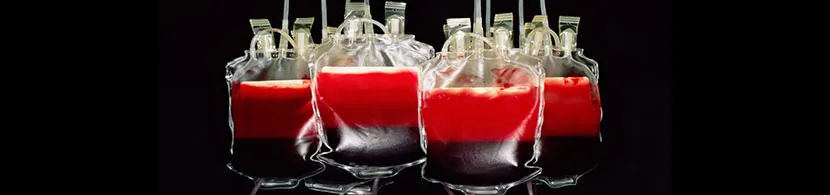 ¿Qué significa si sueñas con sangre propia?